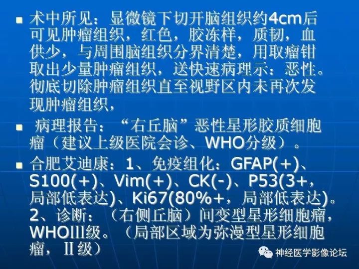 【病例】右侧丘脑间变型星形细胞瘤1例MR影像表现