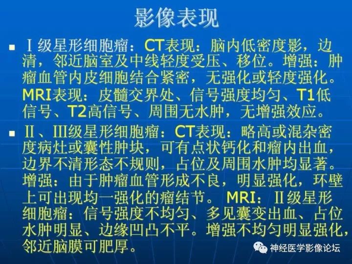 【病例】右侧丘脑间变型星形细胞瘤1例MR影像表现