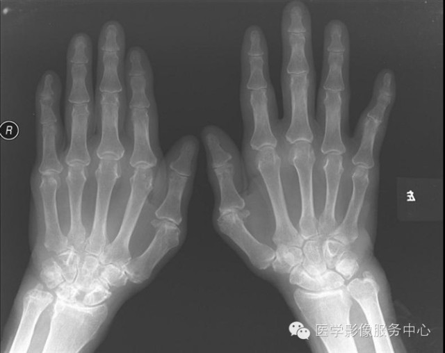 经典、罕见的X线片病例 经典、罕见的X线片病例