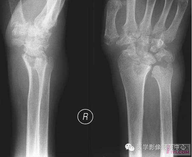 经典、罕见的X线片病例 经典、罕见的X线片病例