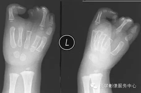 经典、罕见的X线片病例