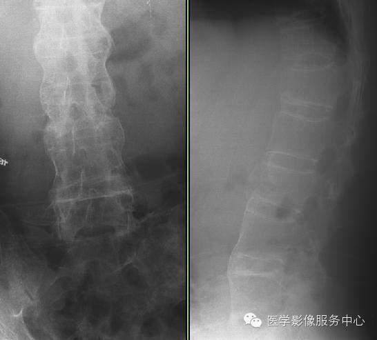 经典、罕见的X线片病例 经典、罕见的X线片病例