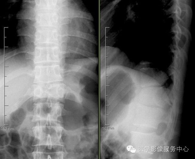 经典、罕见的X线片病例 经典、罕见的X线片病例