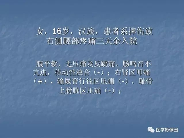 【病例】右肾母细胞瘤1例CT影像表现