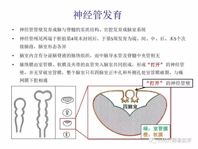 【PPT】侧脑室发育及常见肿瘤与肿瘤样病变的鉴别诊断