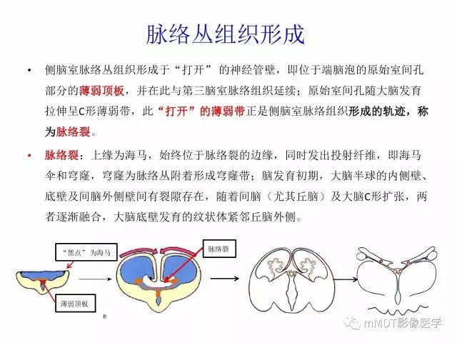 【PPT】侧脑室发育及常见肿瘤与肿瘤样病变的鉴别诊断