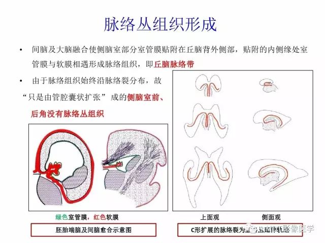 【PPT】侧脑室发育及常见肿瘤与肿瘤样病变的鉴别诊断