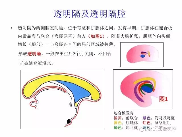 【PPT】侧脑室发育及常见肿瘤与肿瘤样病变的鉴别诊断