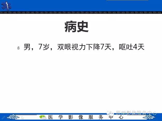 【病例】鞍区毛细胞型星形细胞瘤1例MR