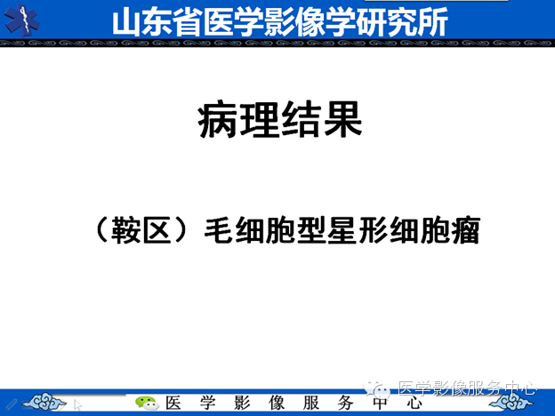 【病例】鞍区毛细胞型星形细胞瘤1例MR