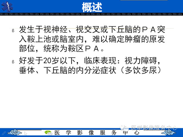 【病例】鞍区毛细胞型星形细胞瘤1例MR