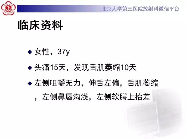 【病例】舌下神经鞘瘤2例MR影像表现