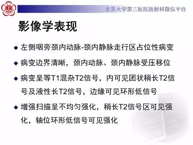 【病例】舌下神经鞘瘤2例MR影像表现