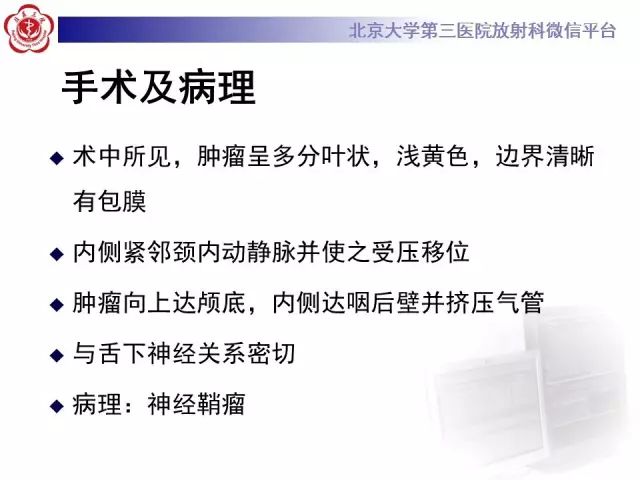 【病例】舌下神经鞘瘤2例MR影像表现