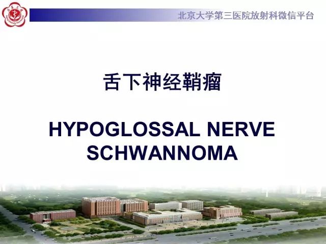 【病例】舌下神经鞘瘤2例MR影像表现