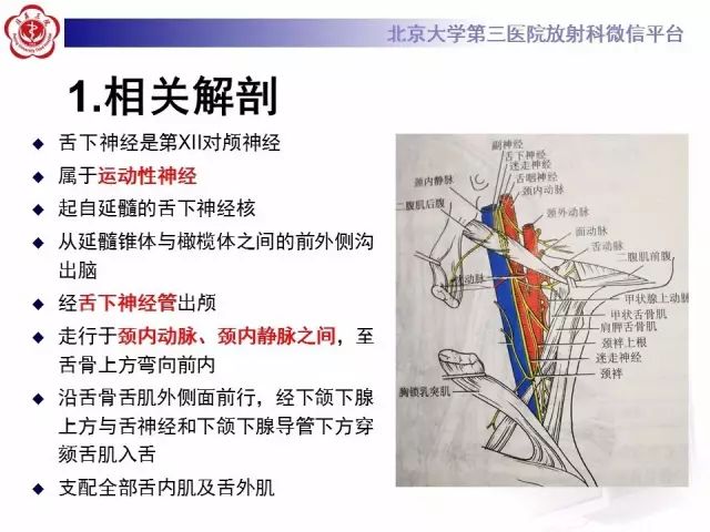 【病例】舌下神经鞘瘤2例MR影像表现