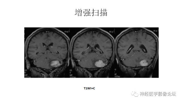 【病例】