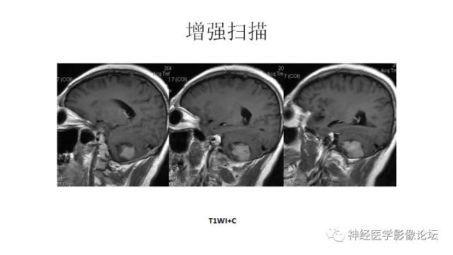 【病例】