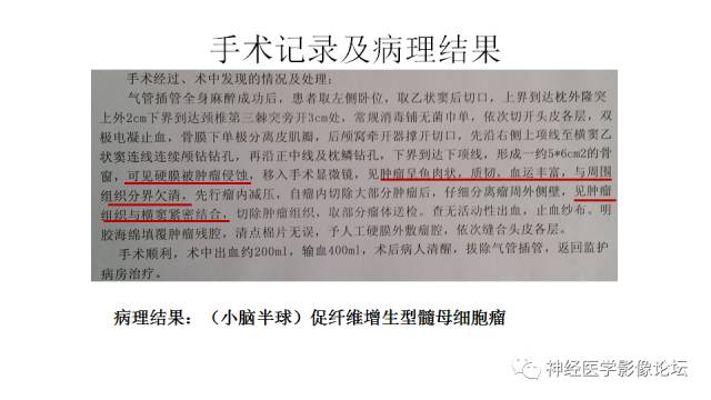 【病例】