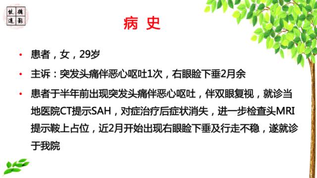 【病例】颅底软骨肉瘤1例CT及MR影像诊断思路