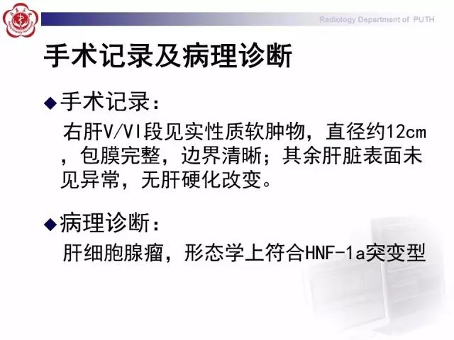 【病例】肝腺瘤1例CT及MR影像表现