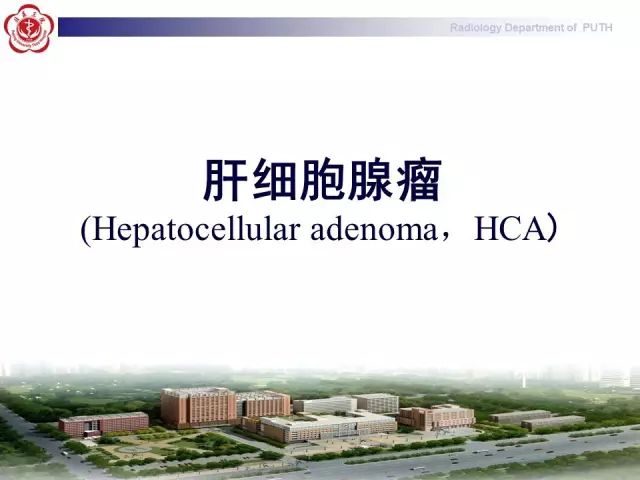 【病例】肝腺瘤1例CT及MR影像表现