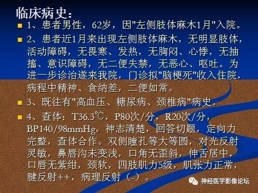 【病例】右顶叶胶质母细胞瘤1例MR影像表现