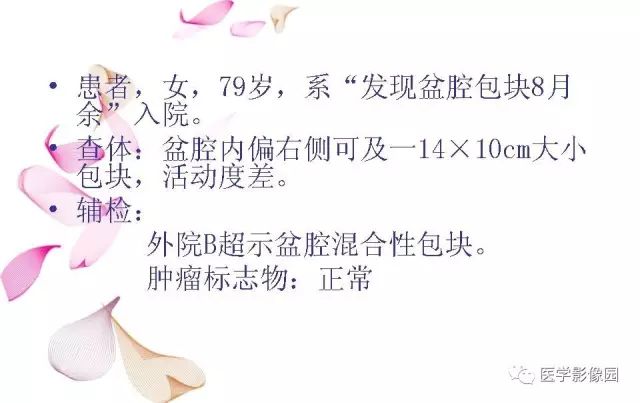 【病例】下腹腔胃肠道外间质瘤1例MR影像表现