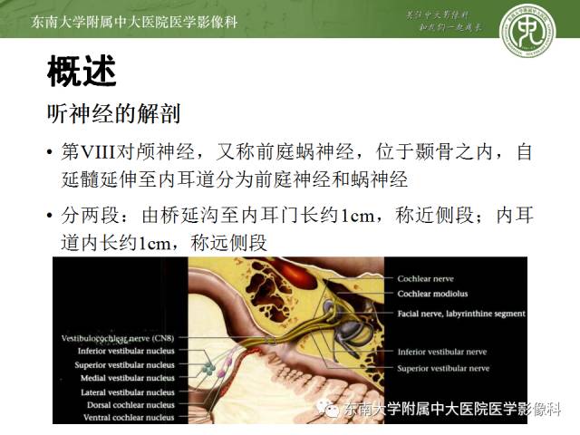 【病例】听神经瘤1例MR