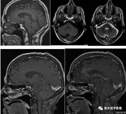 长在斜坡上的9种肿瘤
