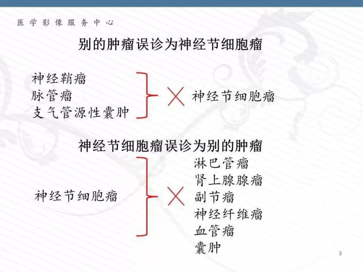 【PPT】腹膜后神经节细胞瘤误诊分析