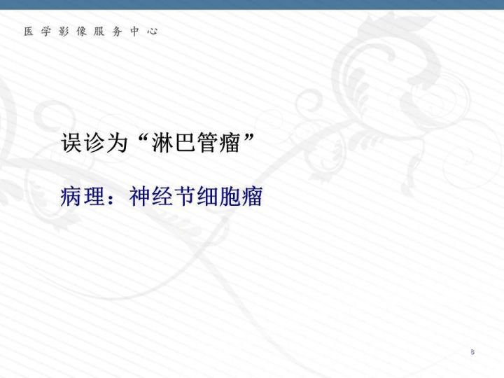 【PPT】腹膜后神经节细胞瘤误诊分析