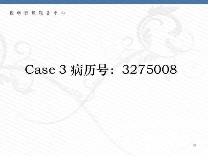 【PPT】腹膜后神经节细胞瘤误诊分析