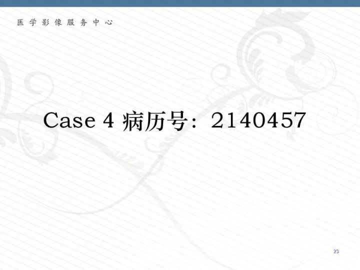 【PPT】腹膜后神经节细胞瘤误诊分析