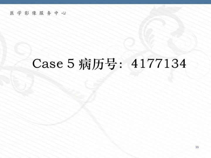 【PPT】腹膜后神经节细胞瘤误诊分析