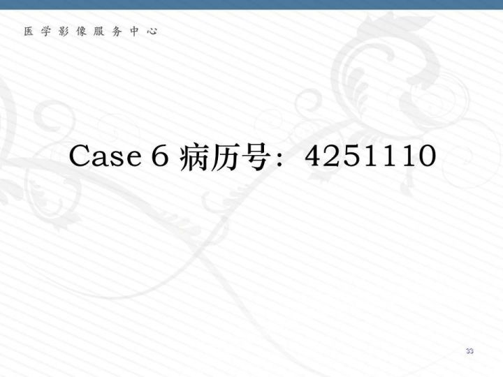 【PPT】腹膜后神经节细胞瘤误诊分析