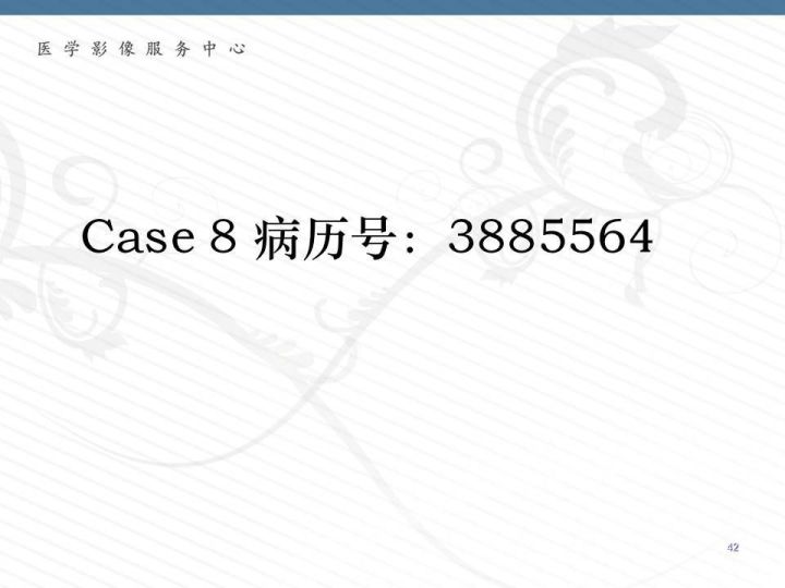 【PPT】腹膜后神经节细胞瘤误诊分析