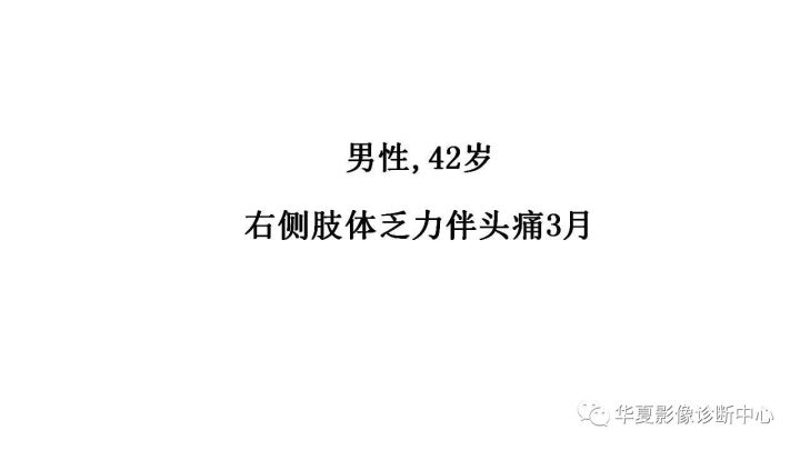 【病例】左颞部微囊型脑膜瘤1例CT及MR影像表现