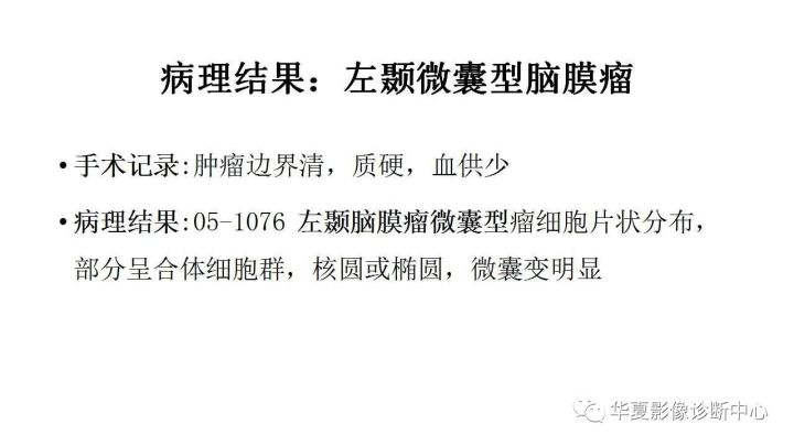 【病例】左颞部微囊型脑膜瘤1例CT及MR影像表现