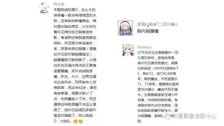 【病例】左颞部微囊型脑膜瘤1例CT及MR影像表现