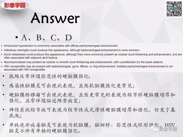 【病例】神经系统结节病1例MR 【病例】神经系统结节病1例MR