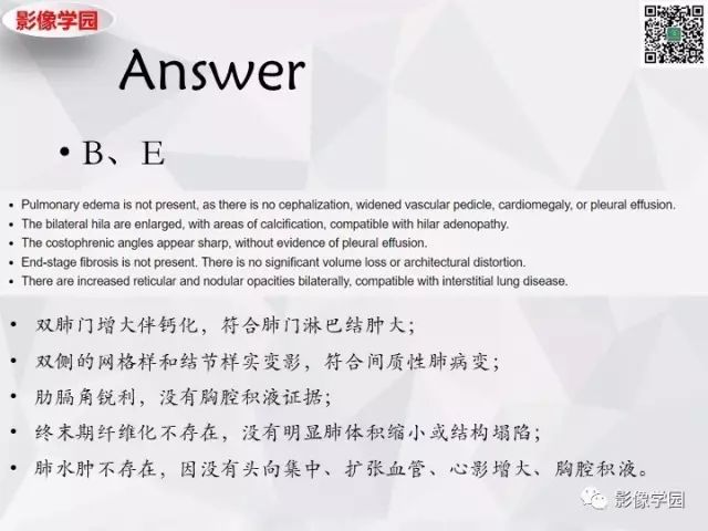 【病例】神经系统结节病1例MR 【病例】神经系统结节病1例MR