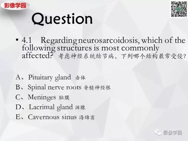 【病例】神经系统结节病1例MR 【病例】神经系统结节病1例MR