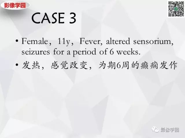 【病例】神经系统结节病1例MR 【病例】神经系统结节病1例MR