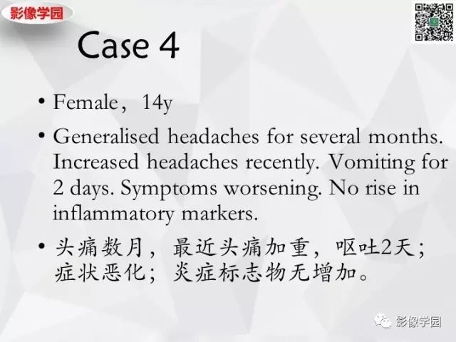 【病例】神经系统结节病1例MR 【病例】神经系统结节病1例MR