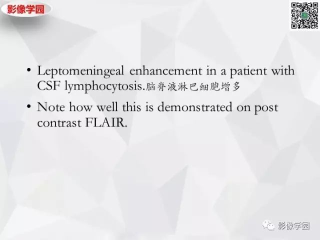 【病例】神经系统结节病1例MR 【病例】神经系统结节病1例MR