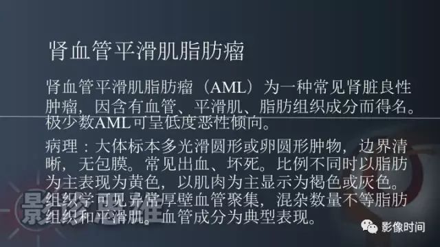 【PPT】肾脏含脂肪病变螺旋CT诊断思路