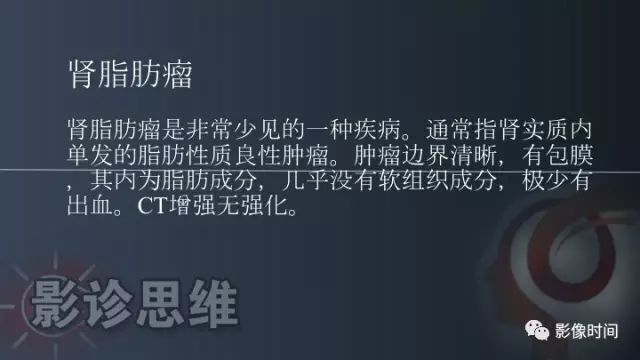 【PPT】肾脏含脂肪病变螺旋CT诊断思路