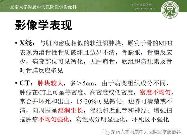 【病例】右侧大腿恶性纤维组织细胞瘤1例