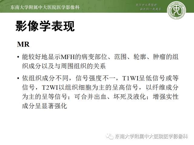 【病例】右侧大腿恶性纤维组织细胞瘤1例